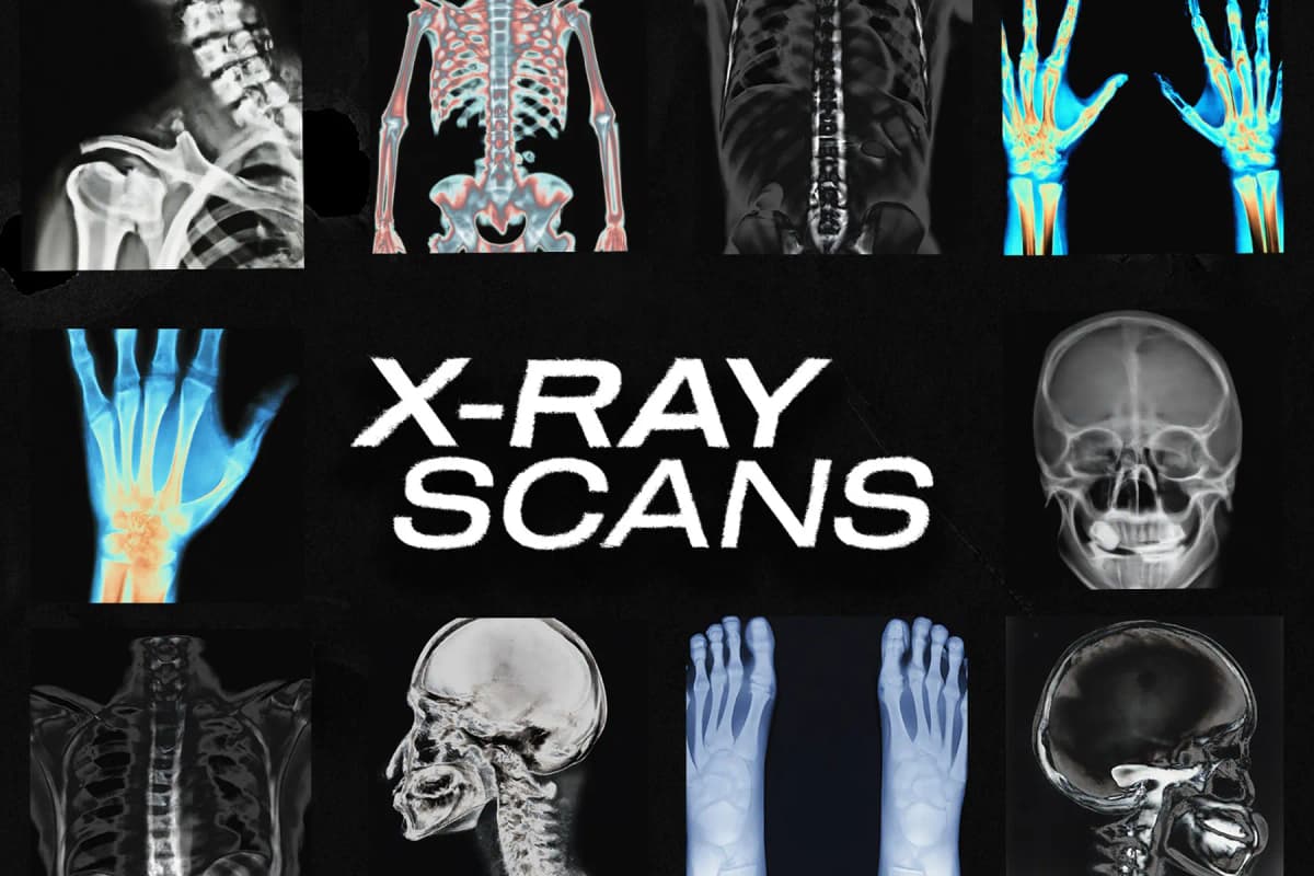 X-RAY SCANS